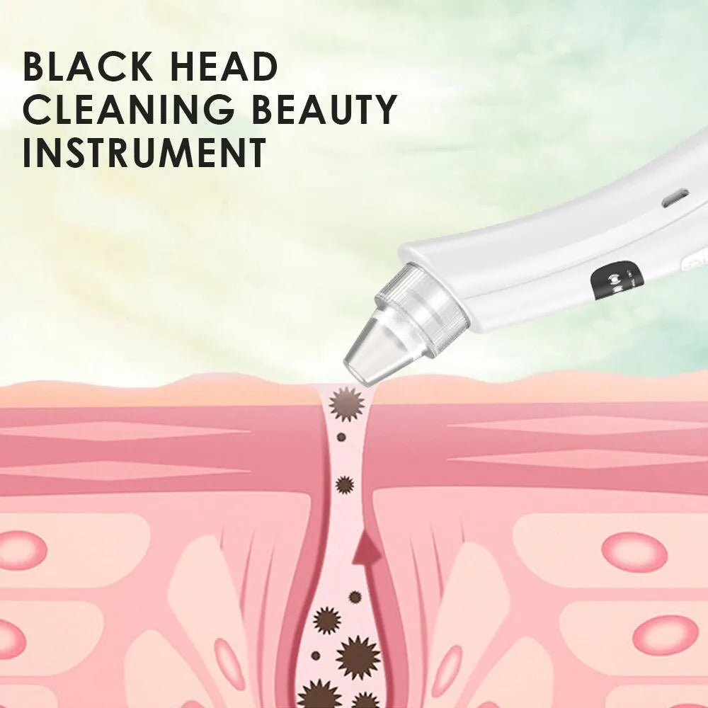 3 Suction Mode Face Cleansing Beauty Machine for Dead Skin & Blackhead Removal
